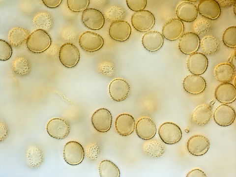 Spores of a slime mold, or myxomycete. Yellow color. High score microscopy. Slime moulds are special organisms that gather from many microscopic unicellular amoebae