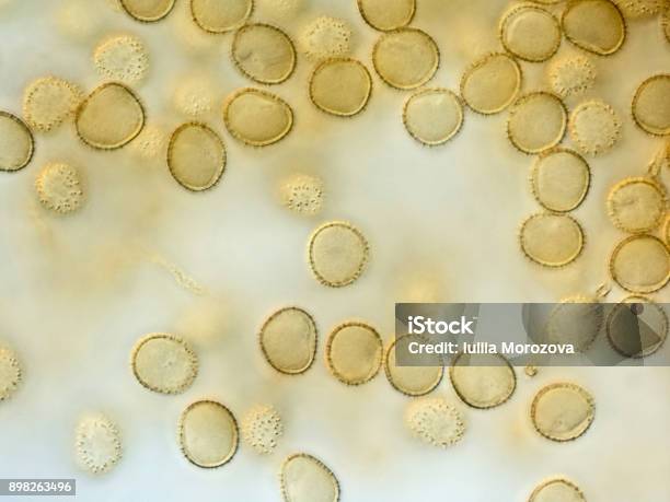 Spores Of A Slime Mold Microscopy Stock Photo - Download Image Now - Microscope, Spore, Mushroom