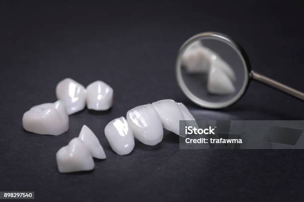 Mundspiegel Mit Zirkon Zahnersatz Auf Einem Dunklen Hintergrund Keramikveneers Lumineers Stockfoto und mehr Bilder von Veneer - Zahnbehandlung