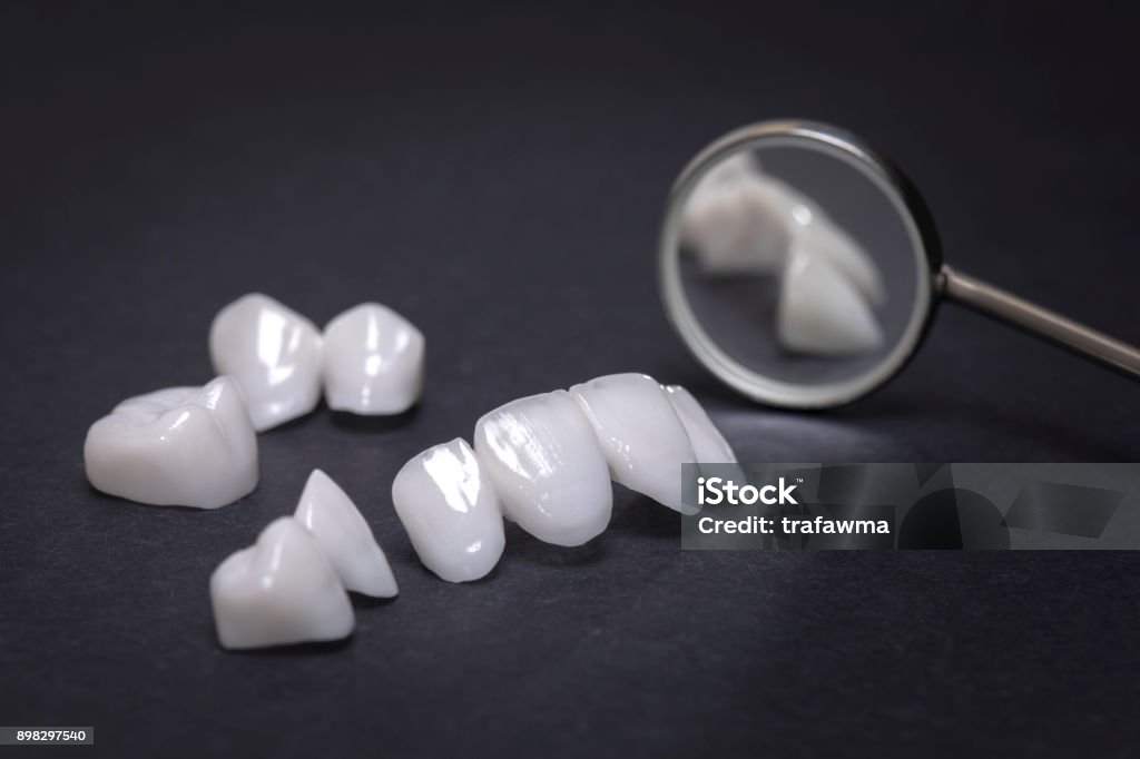Dental mirror with zircon dentures on a dark background - Ceramic veneers - lumineers zircon dentures is a perfect dental cosmetics Dental Veneers Stock Photo