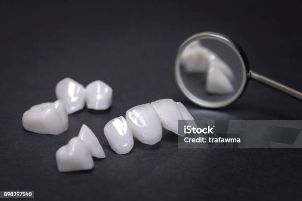 Dental Mirror With Zircon Dentures On A Dark Background Ceramic Veneers Lumineers Stock Photo - Download Image Now