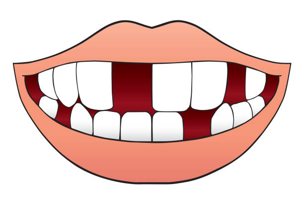 欠損歯と口 - denticle点のイラスト素材／クリップアート素材／マンガ素材／アイコン素材