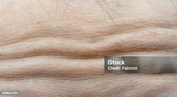Macro Shot Detail Of Forehead Wrinkles From Emotional Expression Collagen And Botox Face Injections Concept Dry Forehead Of Face Skin Of Menopause Woman Stock Photo - Download Image Now