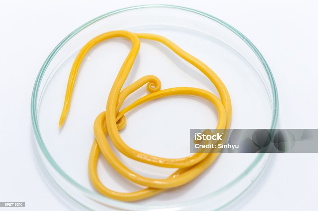 Ascariasis Ist Eine Erkrankung Die Durch Parasitäre Fadenwurm Ascaris