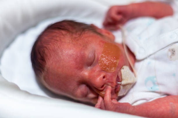 istock Premature baby in the neonatal intensive care 898816694