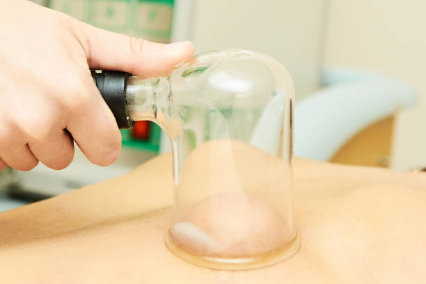 istock Medical procedure. Vacuum massage. Losing weight 898865746