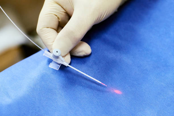 istock Laser removal veins. Treatment couperose. Varicose veins 898878264