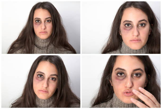 Four portraits of an abused woman stock photo