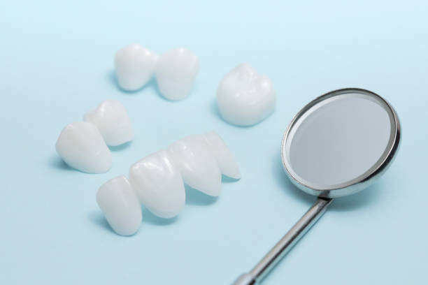 istock Dental mirror and zircon dentures on a light blue background - Ceramic veneers - lumineers 898998140