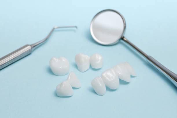 istock Dental tools and zircon dentures on a light blue background - Ceramic veneers - lumineers 898998240