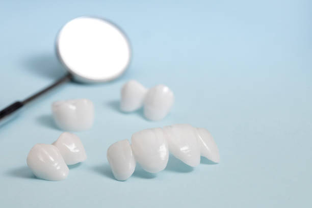 istock Dental mirror and zircon dentures on a light blue background - Ceramic veneers - lumineers 898998452