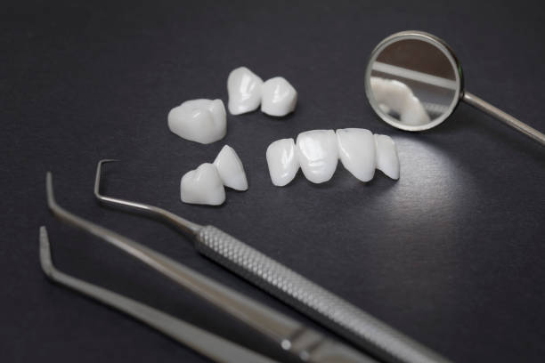 istock Dental tools and zircon dentures on a dark background - Ceramic veneers - lumineers 898998610