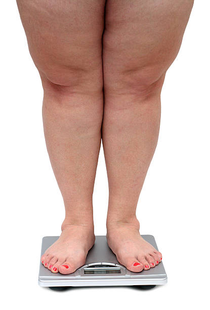 istock women legs with overweight 89908406