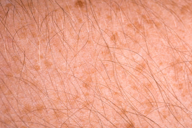 istock dark spots on male hairy arm 899446672