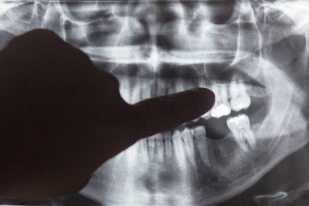 istock x-ray image of teeth and mouth 899464752
