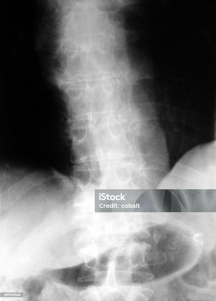 Radiografía de la columna y la Pelvis - Foto de stock de Asistencia sanitaria y medicina libre de derechos