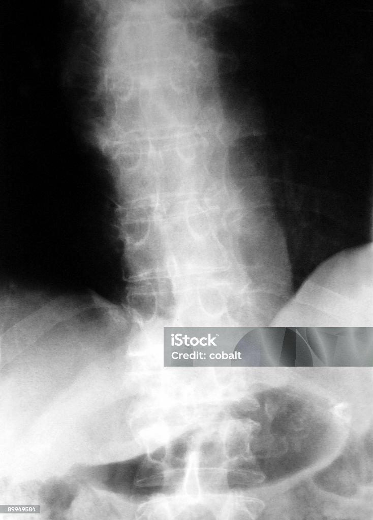 척추 및 골반 X-선 - 로열티 프리 0명 스톡 사진