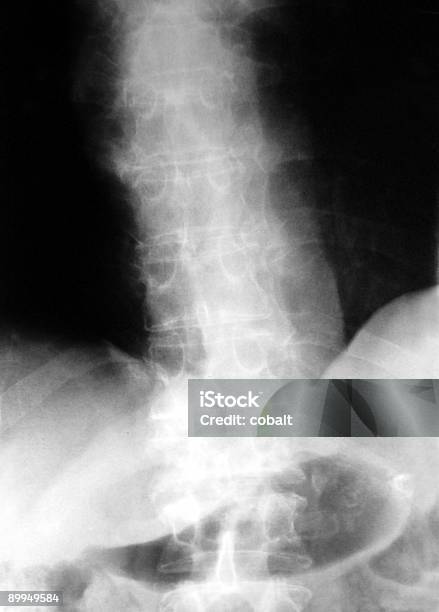 척추 및 골반 X선 0명에 대한 스톡 사진 및 기타 이미지 - 0명, X-레이, 건강 진단