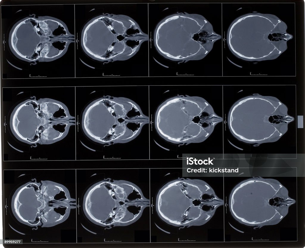 Head Ct Scan Sample Ct Scan Head Stock Photo - Download Image Now - CAT Scan, Color Image ...