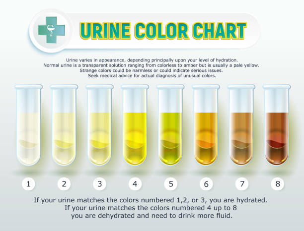 wykres kolorów moczu 1 - uric acid stock illustrations