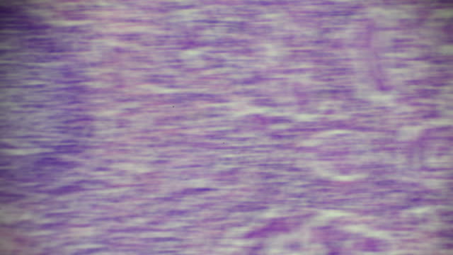 The spleen tissue under light microscopy