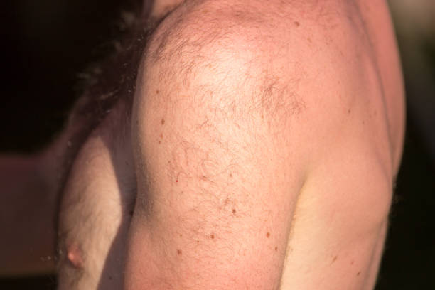 istock Hair on the shoulder of a man 900294502