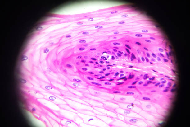 estratificado epitelio escamoso ver en microscopia - human tissue histology dermatology human skin fotografías e imágenes de stock