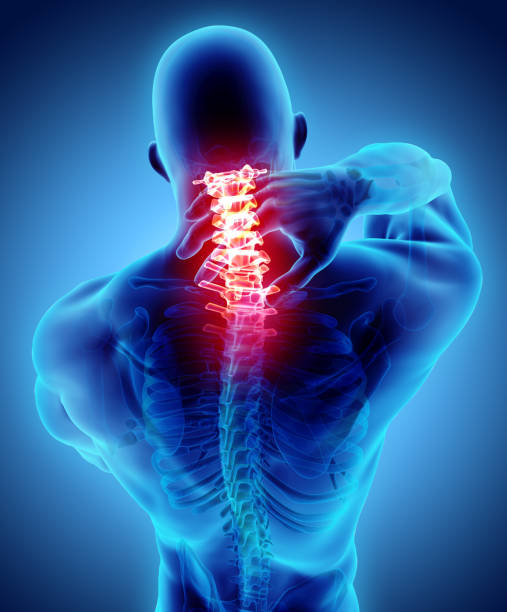 istock Neck painful - cervical spine skeleton x-ray, 3D illustration. 900630072