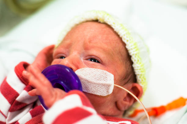 bebé prematuro en la unidad de cuidados intensivos neonatales con los ojos abiertos. - 5954 fotografías e imágenes de stock