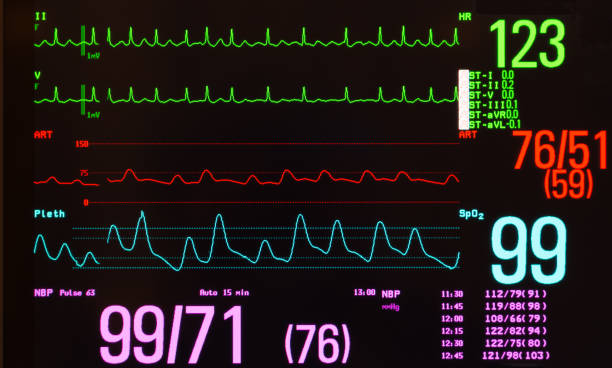 istock Atrial Flutter with Variable Conduction, Blood Pressure, Pulse Oxymeter and Vital Signs on Monitor with Black Screen 900699224