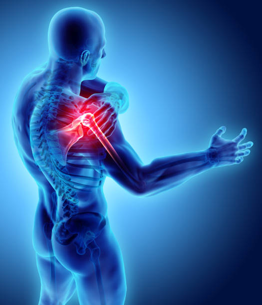 istock Shoulder painful skeleton x-ray, 3D illustration. 900792498