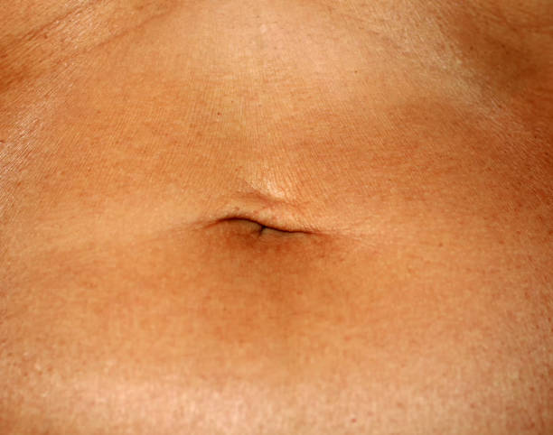 flabby wrinkled abdomen. the navel is stretched. - belly button imagens e fotografias de stock