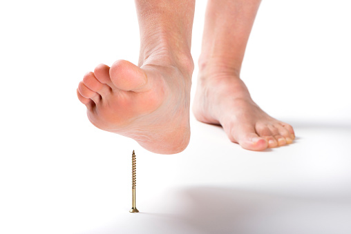 barefoot stepping on peaked screw