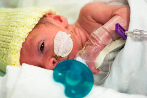 Photo of Premature baby in the neonatal intensive care unit with a pacifier