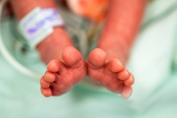 Foot of a premature baby in the neonatal intensive care unit stock photo