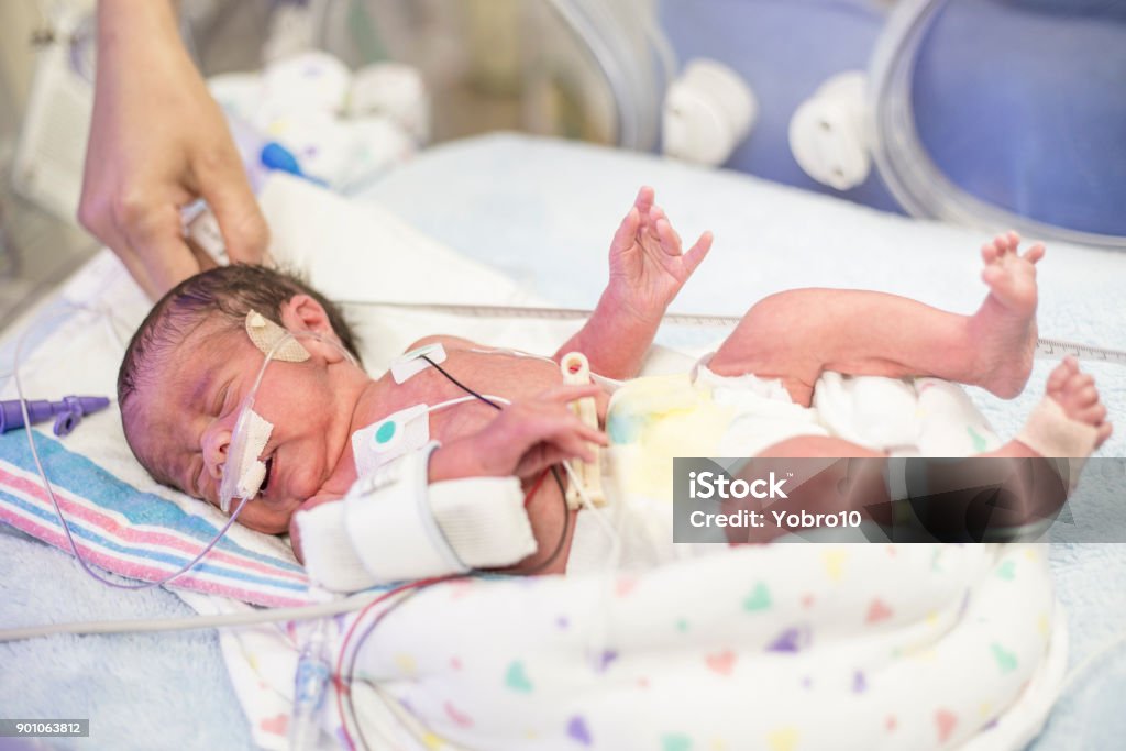 Vorzeitigen Neugeborenen in der Neonatologie Intensivstation - Lizenzfrei Frühgeburt Stock-Foto