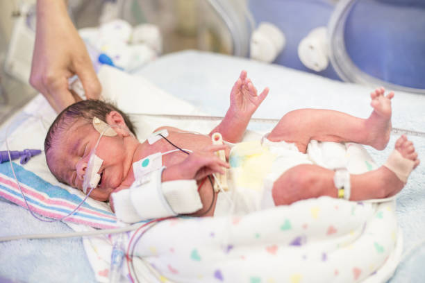 Newborn premature baby in the NICU intensive care stock photo