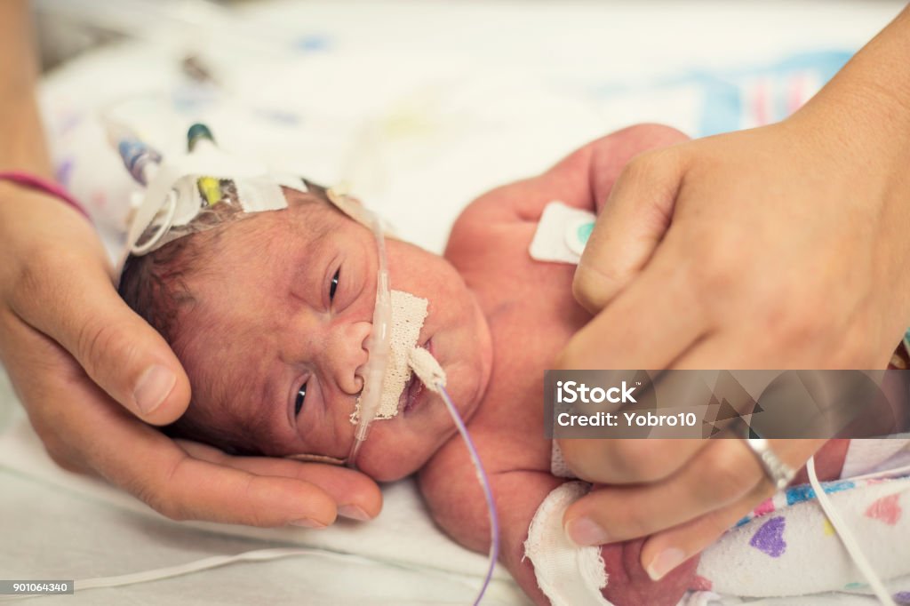 Vorzeitigen Neugeborenen in der Neonatologie Intensivstation - Lizenzfrei Frühgeburt Stock-Foto