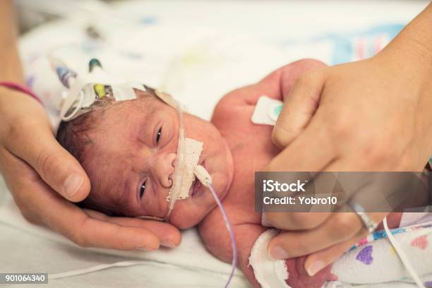 Vorzeitigen Neugeborenen In Der Neonatologie Intensivstation Stockfoto und mehr Bilder von Frühgeburt