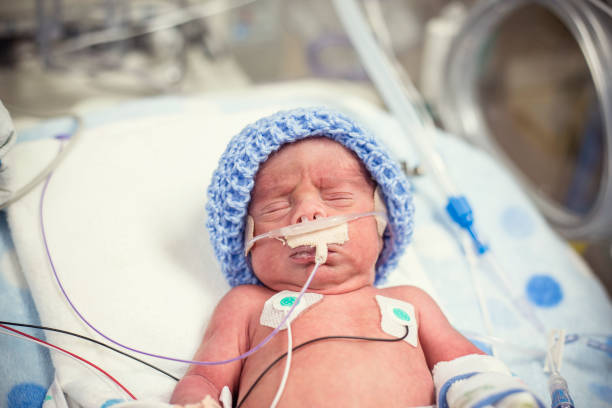 Newborn premature baby in the NICU intensive care stock photo