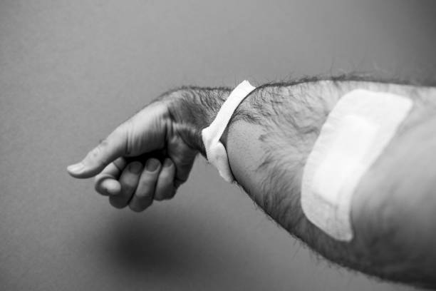 Close-up detail of man hand with adhesive tape after blood transfusion Close-up detail of man hand with adhesive tape after blood transfusion  analysis with part of the hair been removed by shaving - black and white image farmacia stock pictures, royalty-free photos & images