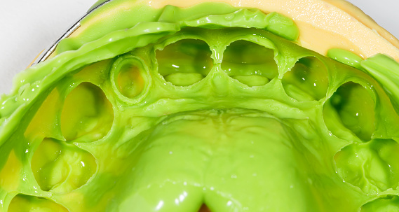 Close up photo of green silicone dental impression