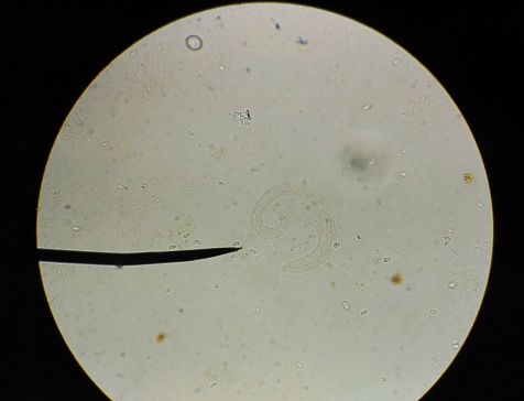 Close up egg with adult of parasite findind with microscope in parasitology.