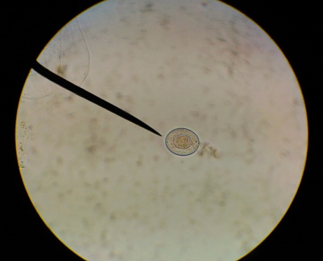 Close up egg with adult of parasite findind with microscope in parasitology.