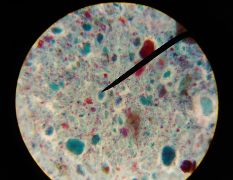 Gardia lamblia protozoa with trichrom stain in parasitology laboratory.
