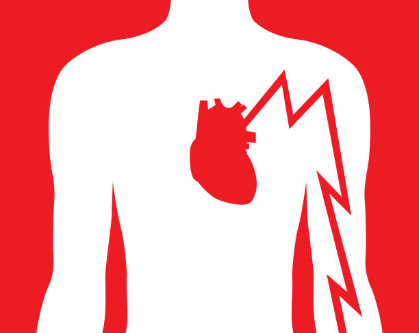 Ilustrasi vektor dada seorang pria dan jantung merah dengan simbol rasa sakit turun lengan kirinya.
