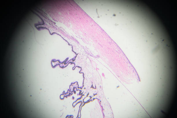 70+ Muscolo Ciliare Foto stock, immagini e fotografie royaltyfree iStock