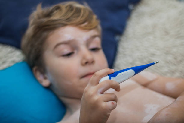 istock Close up of kid with chickenpox measuring temperature. 902251320