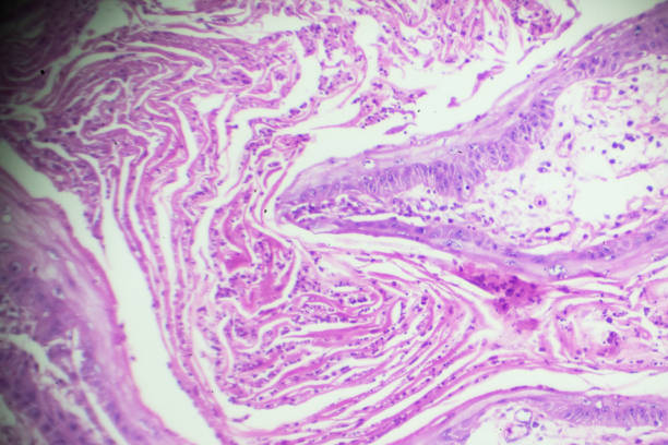 carcinoma de célula squamous bajo microscopia - laboratory healthcare and medicine cancer drug histology fotografías e imágenes de stock
