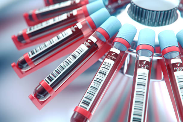 Lab equipment centrifuging blood. Concept image of a blood test.3d rendering. stock photo